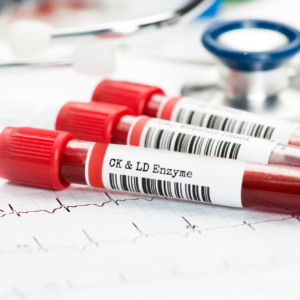 Blood samples prepared for laboratory diagnostic testing
